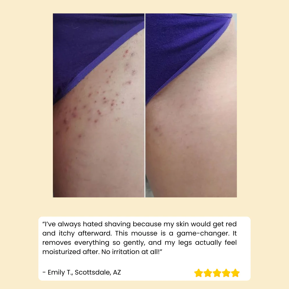 HoneyMousse™ — Experience Pain-Free, Irresistibly Smooth Skin That Lasts Weeks - Image 7