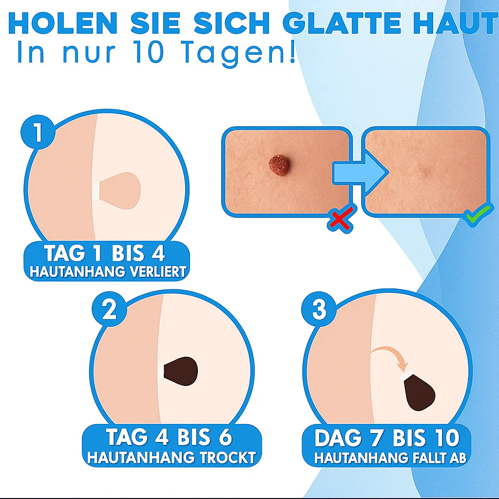 Derma Roller Pro – Say Goodbye to Unwanted Skin Growths - Image 3