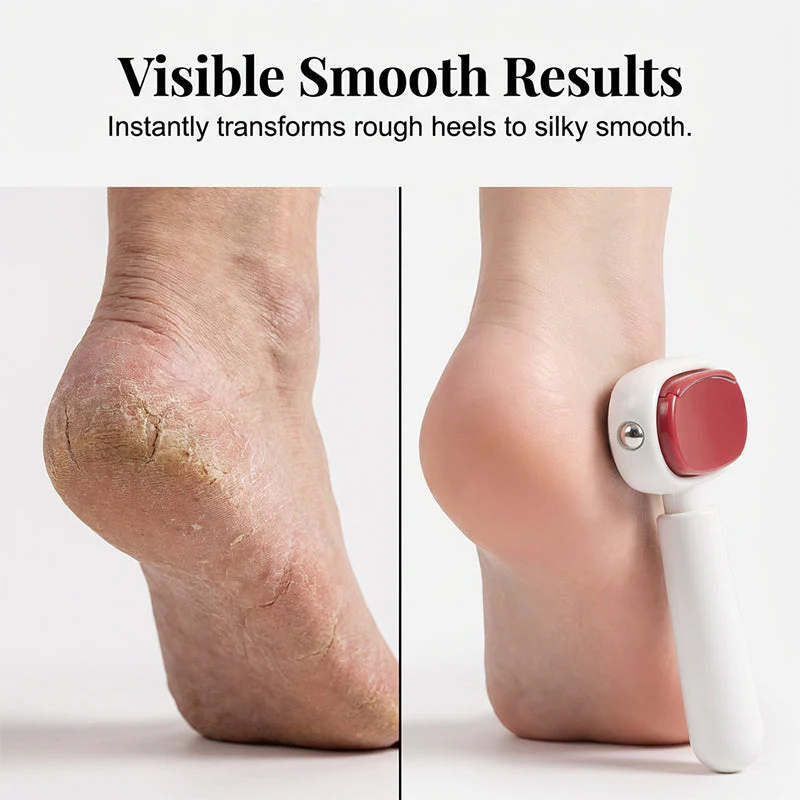 Double-Sided Foot Scraper for Callus Removal - Image 3