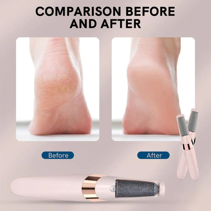Electric Callus Remover with USB Charging - Image 8