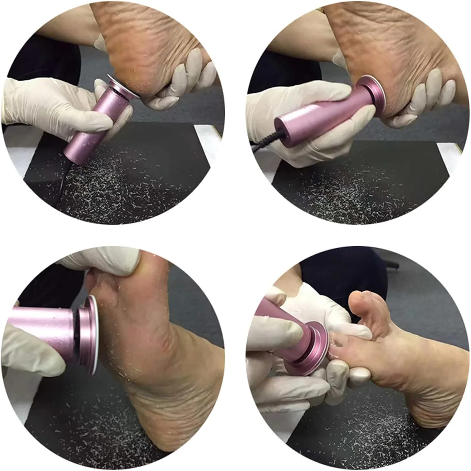 Electric Heel Remover for Healthy Feet - Image 3