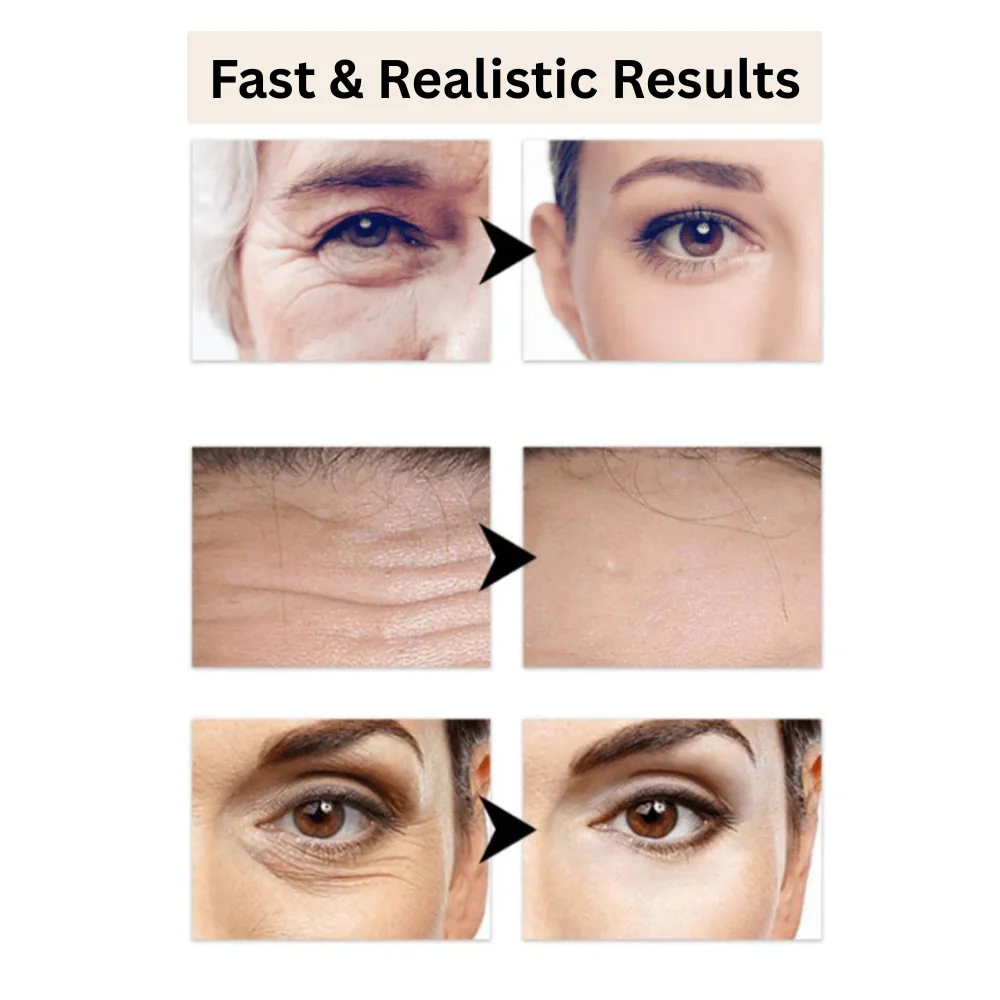 PerfectSync™ — Erase Fine Lines & Glow Naturally | 1+1 FREE Today - Image 3
