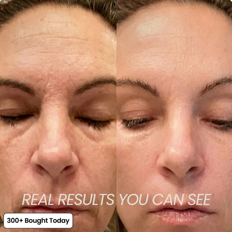 Her+ Calcium™ — Swipe Away Wrinkles, Smile Lines & Tired Under-Eyes In Seconds - Image 10