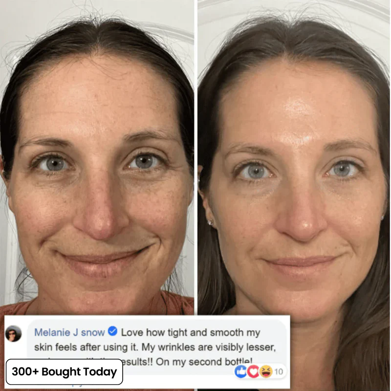 Her+ Calcium™ — Swipe Away Wrinkles, Smile Lines & Tired Under-Eyes In Seconds - Image 12