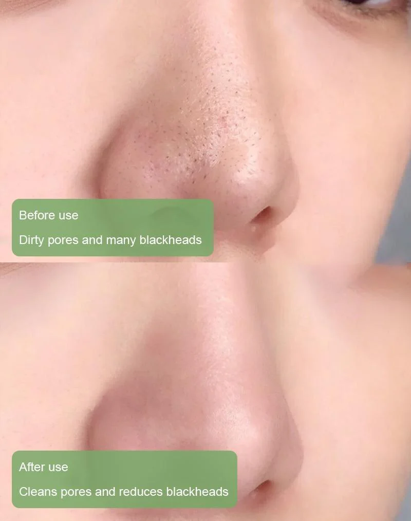 PurifyMist™ — Unleash Clear, Radiant Skin That Glows with Confidence - Image 6
