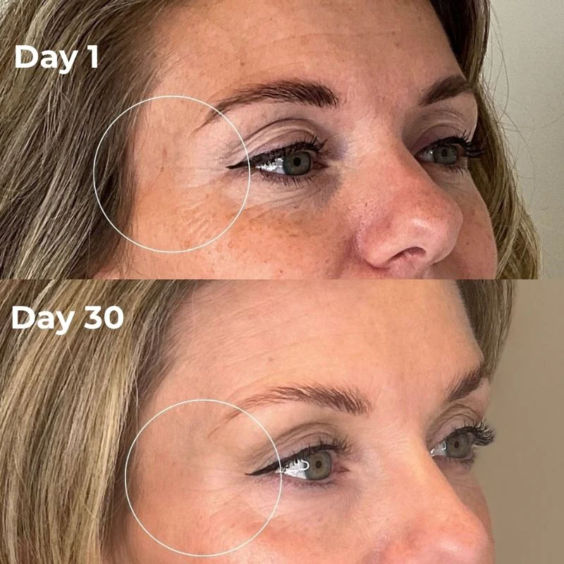Red Light Therapy Device for Under Eye Treatment at Home - Image 7
