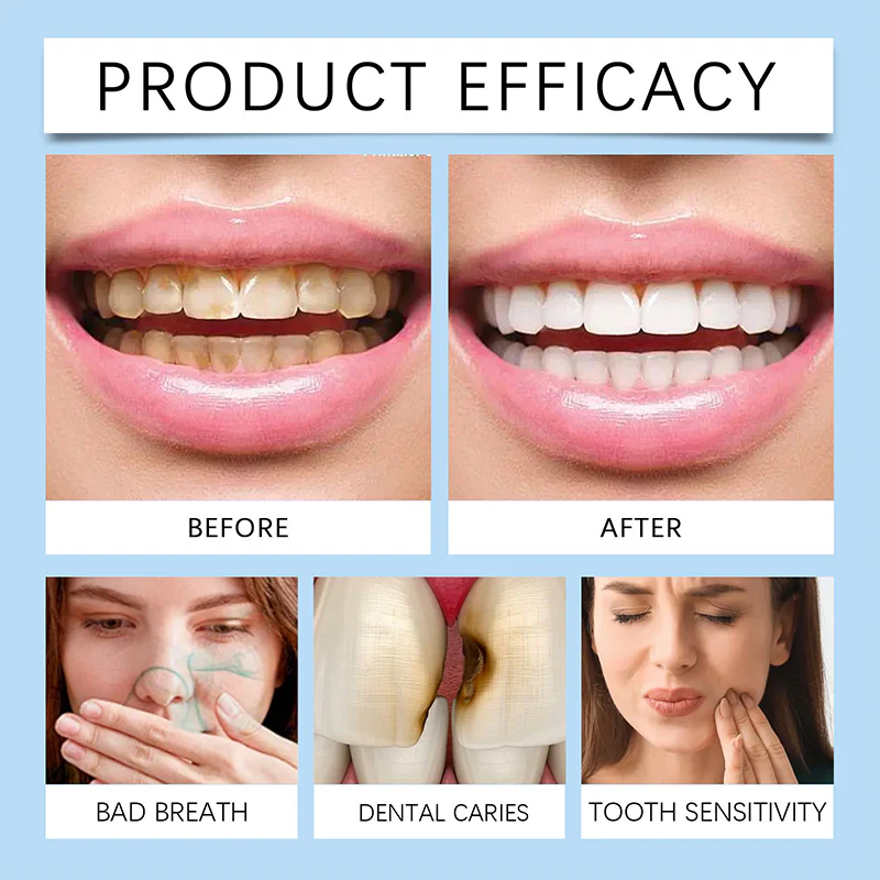 ShineGuard™ — Instant Enamel Strength & Sensitivity Relief for Unstoppable Smiles - Image 4