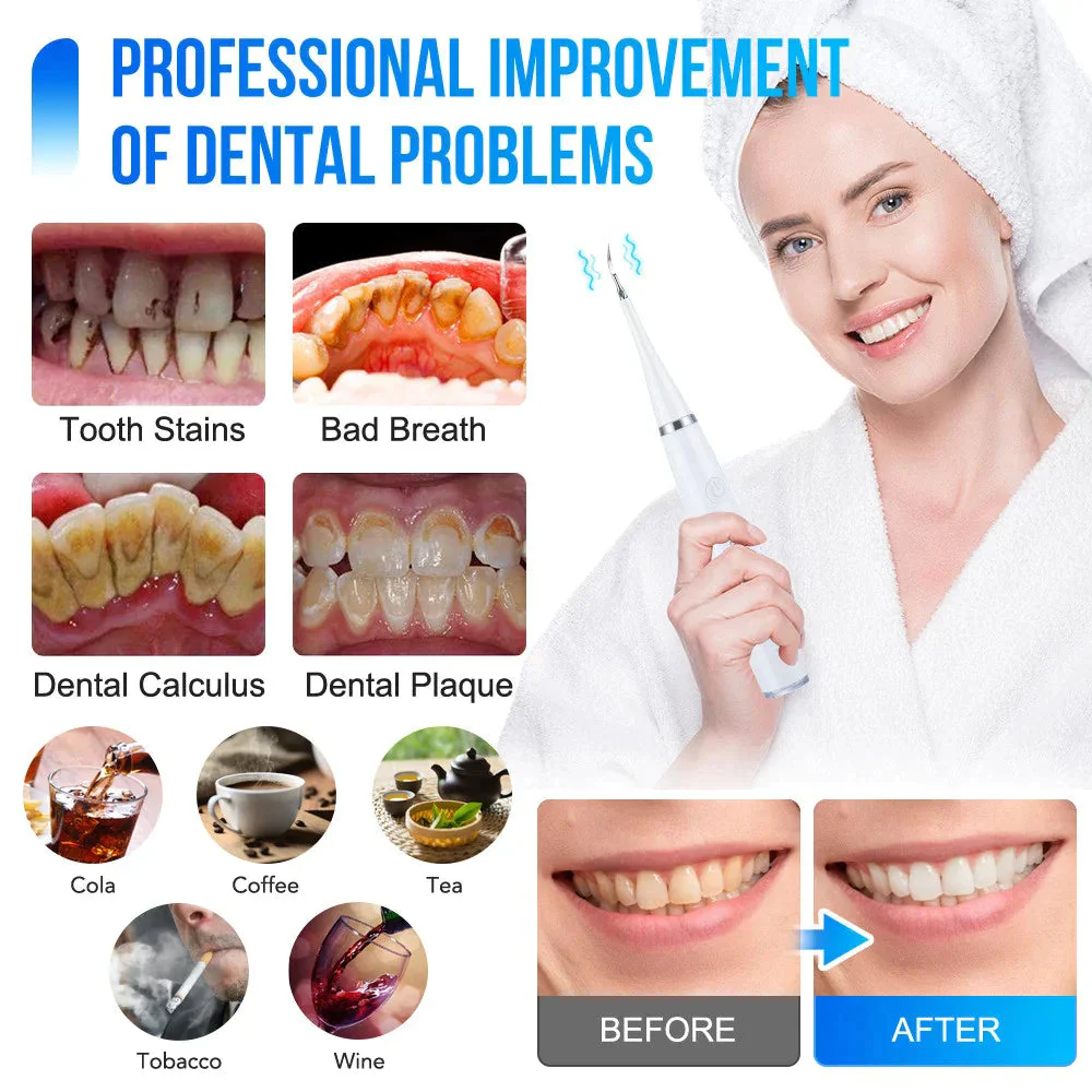SmilePulse™ — Effortless Deep Cleaning for a Radiant, Confident Smile Every Day - Image 2