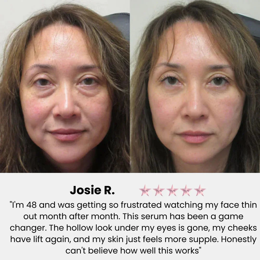 VivaDerm™ — Instantly Lift and Radiate Confidence with Youthful, Plump Skin - Image 3