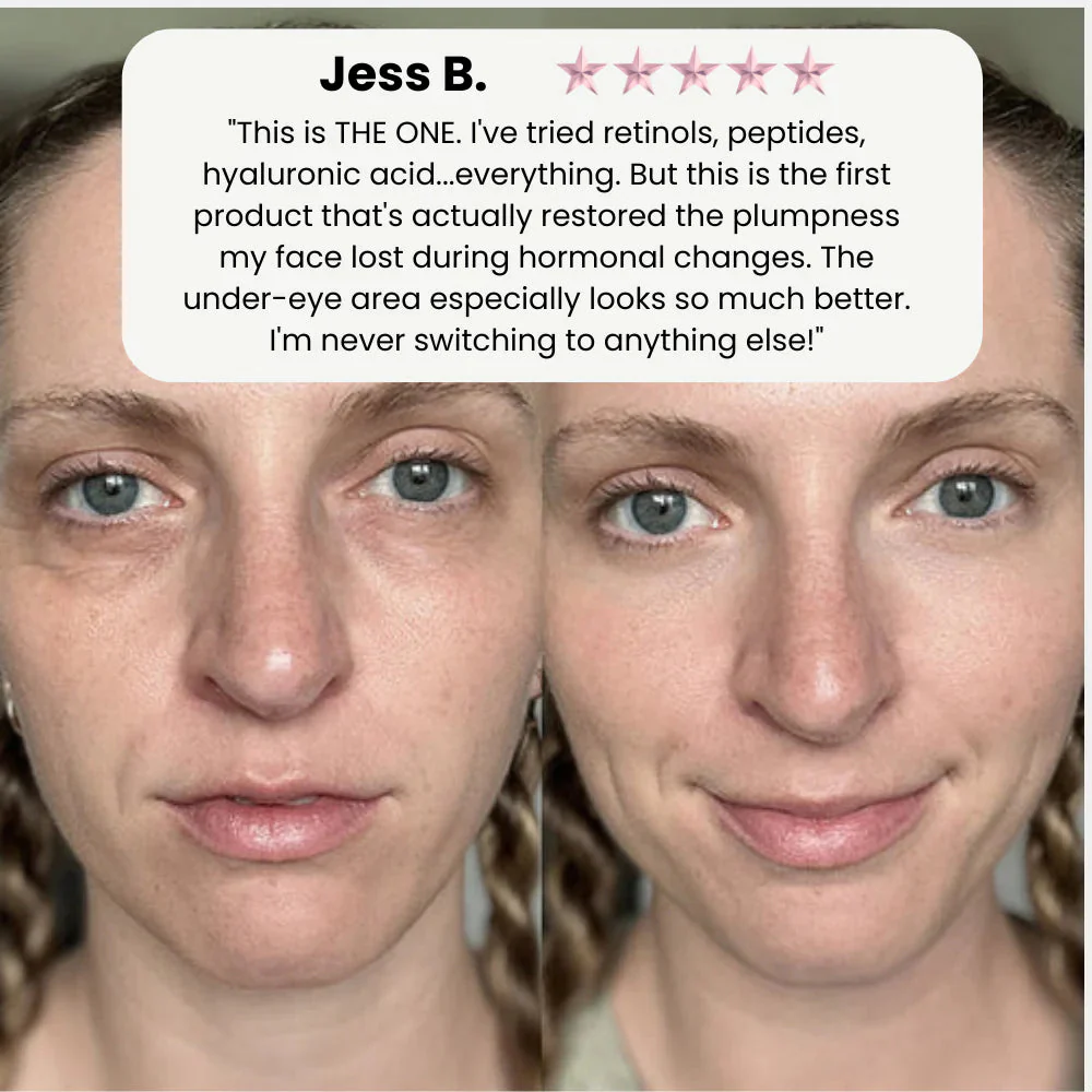 VivaDerm™ — Instantly Lift and Radiate Confidence with Youthful, Plump Skin - Image 4