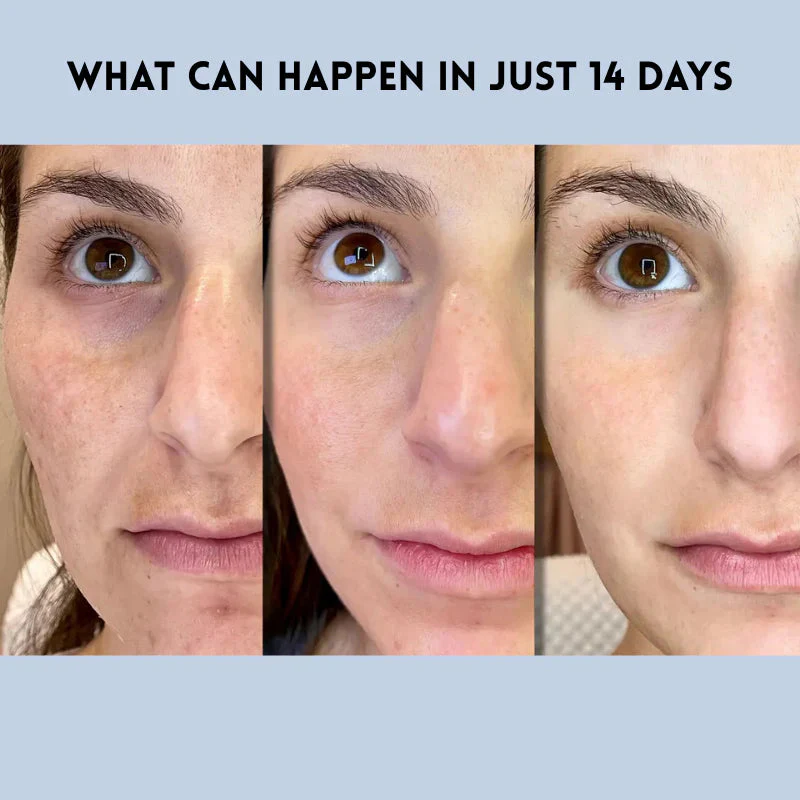 VivaLift™ — Instantly Transform Your Look with a Radiant, Youthful Glow - Image 6