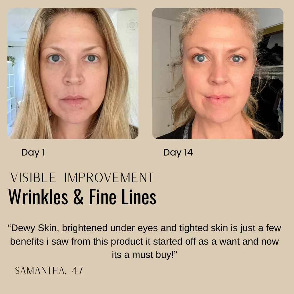 VivaSculpt™ Skin Firming Cream — Reveal Lifted, Radiant Skin That Defies Time Without Needles - Image 6